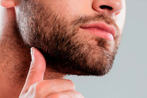 Implante de barba