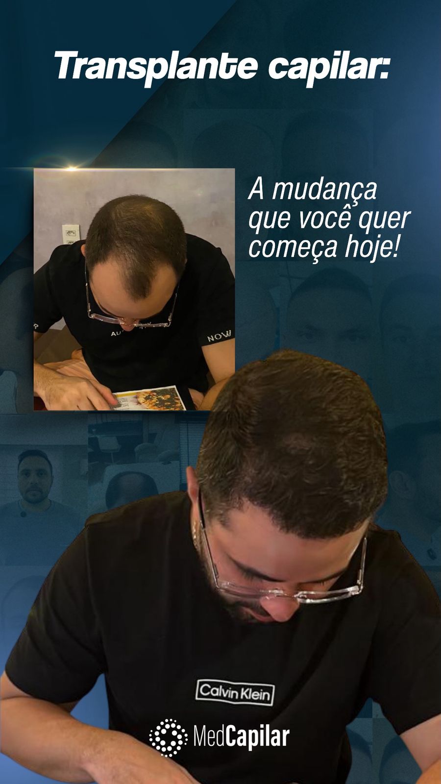 Antes e depois paciente 3
