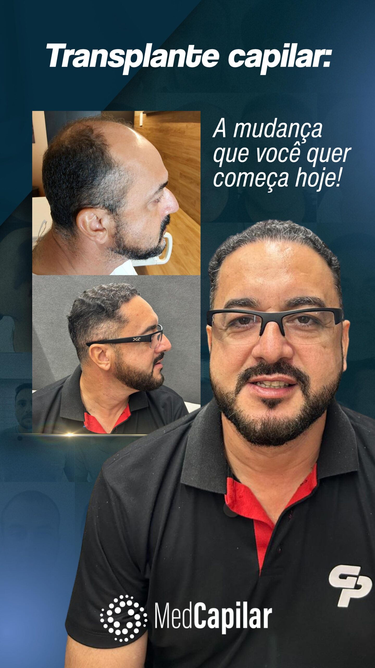 Antes e depois paciente 1